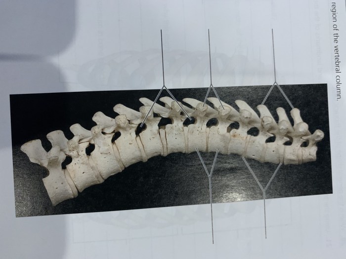 Exercise 9 the axial skeleton