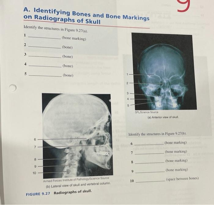 Exercise 9 the axial skeleton